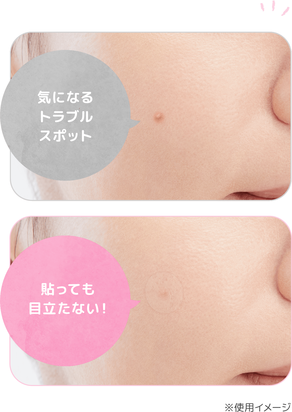 気になるトラブルスポット 貼っても目立たない！ ※使用イメージ