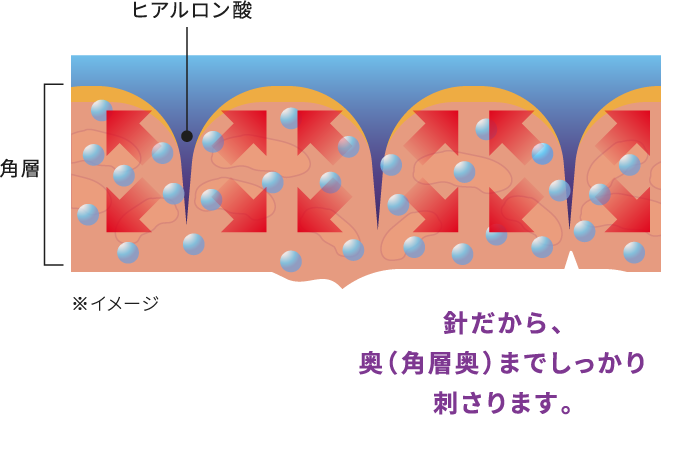 ヒアロチューン マイクロパッチ ｜ クリアターン ［CLEAR TURN］